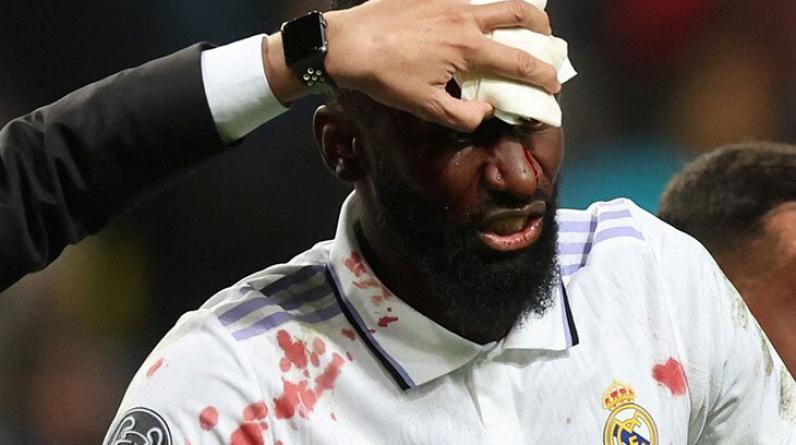 Рюдигер спас «Реал» ценой собственного лба. Жуткое столкновение в матче против «Шахтера»